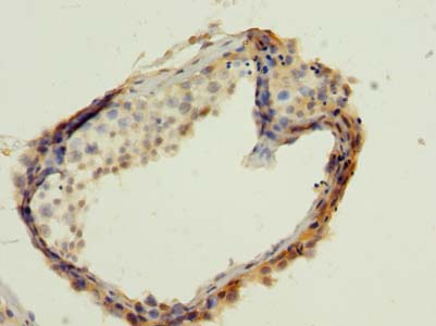 WBP2 Polyclonal Antibody