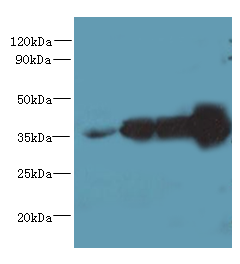 WDR61 Polyclonal Antibody