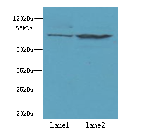 WDTC1 Polyclonal Antibody