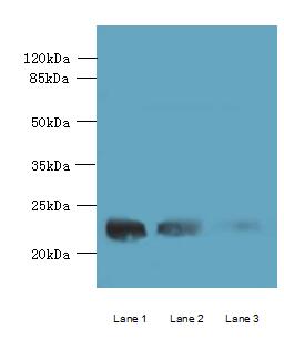 WDYHV1 Polyclonal Antibody