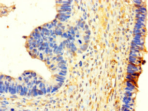 WHSC1L1 Polyclonal Antibody