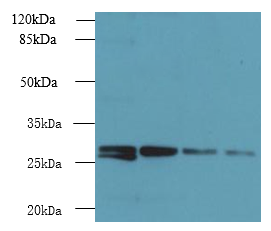YIPF4 Polyclonal Antibody