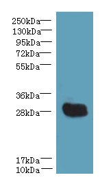 YIPF5 Polyclonal Antibody
