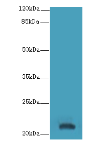YKT6 Polyclonal Antibody
