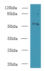 ZBTB18 Polyclonal Antibody