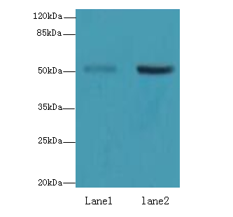 ZBTB32 Polyclonal Antibody