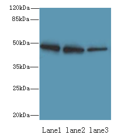ZBTB6 Polyclonal Antibody