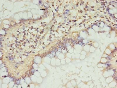 ZC3H12A Polyclonal Antibody