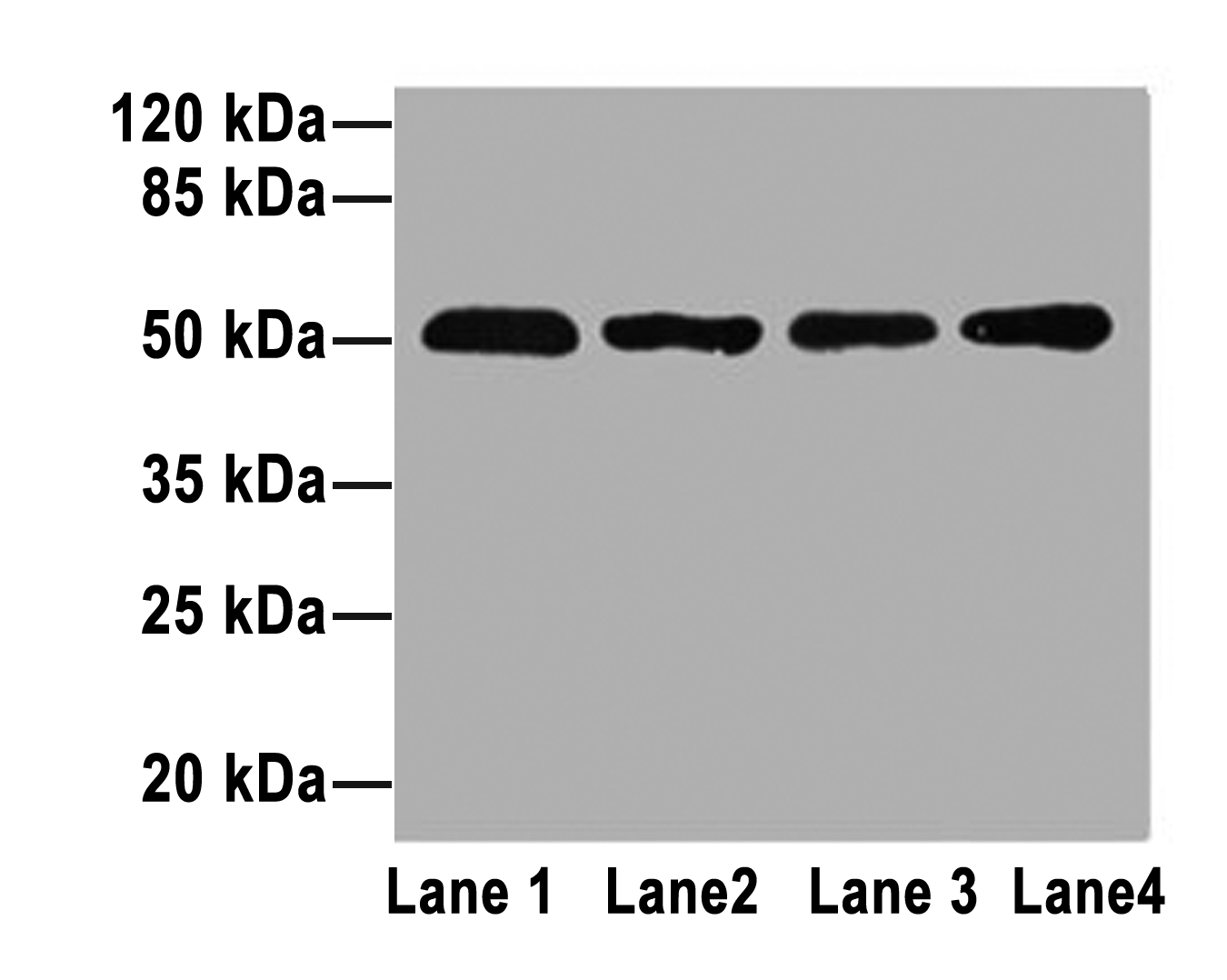 ZDHHC23 Polyclonal Antibody