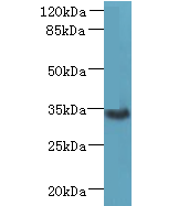 ZDHHC3 Polyclonal Antibody
