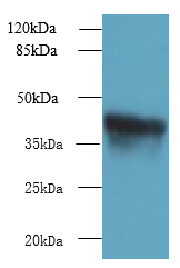 ZDHHC4 Polyclonal Antibody