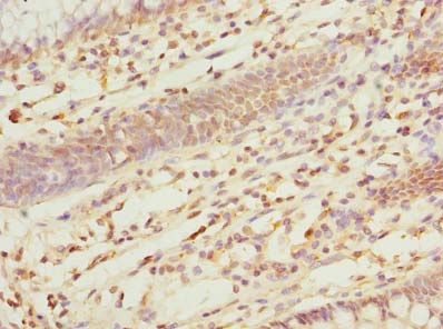 ZDHHC5 Polyclonal Antibody