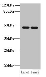 ZDHHC6 Polyclonal Antibody