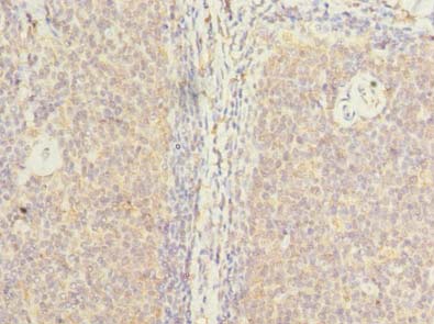 Immunohistochemistry of paraffin-embedded human tonsil tissue using ZHX1-C8orf76 Polyclonal Antibody at dilution of 1:100