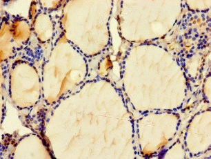 ZMAT4 Polyclonal Antibody
