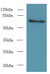 ZNF133 Polyclonal Antibody