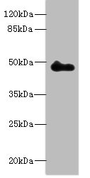 Western blot<br />All lanes: ZNF232 Polyclonal Antibody at 0.8ug/ml+ Mouse heart tissue<br />Goat polyclonal to rabbit at 1/10000 dilution<br />Predicted band size: 48, 47 kDa<br />Observed band size: 48 kDa<br />