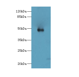 ZNF232 Polyclonal Antibody