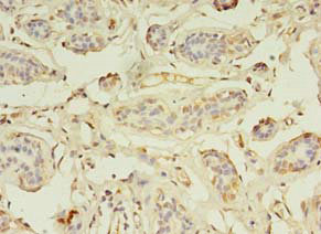 ZNF266 Polyclonal Antibody