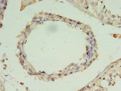 ZNF397 Polyclonal Antibody