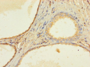 ZNF432 Polyclonal Antibody