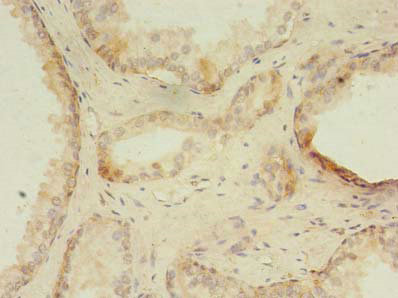 ZNF502 Polyclonal Antibody