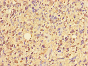 ZNF559 Polyclonal Antibody