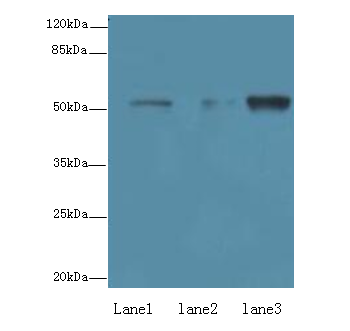 ZNF610 Polyclonal Antibody