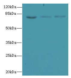 ZNF614 Polyclonal Antibody