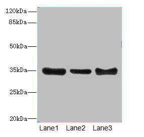 ZNF625 Polyclonal Antibody