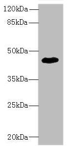 Western blot<br />All lanes: ZNF670 Polyclonal Antibody at 5ug/ml+ HepG-2 whole cell lysate<br />Goat polyclonal to rabbit at 1/10000 dilution<br />Predicted band size: 45 kDa<br />Observed band size: 45 kDa<br />