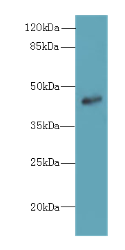 ZNF670 Polyclonal Antibody