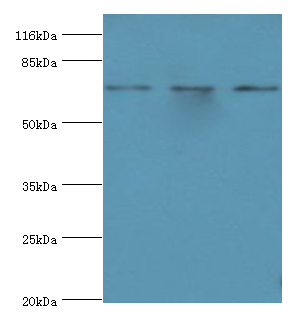 ZNF699 Polyclonal Antibody