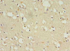 Immunohistochemistry of paraffin-embedded human brain tissue at dilution 1:100