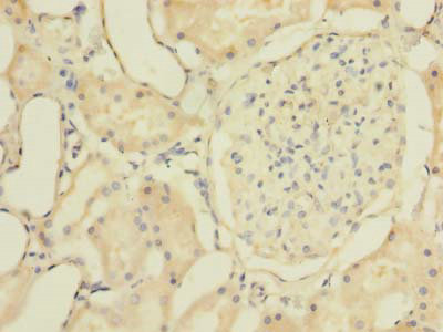 ZNF707 Polyclonal Antibody