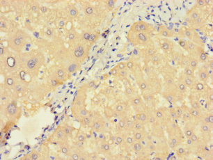 ZNF738 Polyclonal Antibody