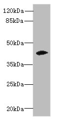 Western blot<br />All lanes: ZSCAN9 Polyclonal Antibody at 0.3ug/ml+ Mouse brain tissue<br />Goat polyclonal to rabbit at 1/10000 dilution<br />Predicted band size: 46, 52 kDa<br />Observed band size: 46 kDa<br />