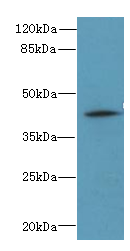 ZSCAN9 Polyclonal Antibody