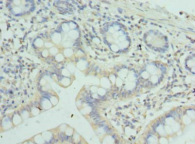 Immunohistochemistry of paraffin-embedded human small intestine tissue at dilution of 1:100