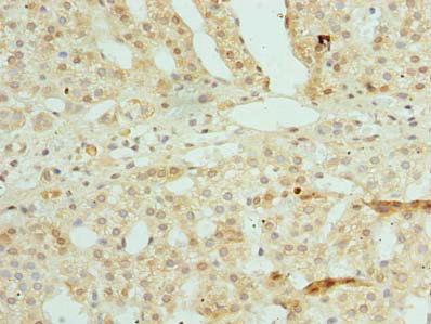 Immunohistochemistry of paraffin-embedded human adrenal gland tissue at dilution of 1:100