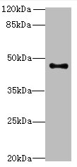 Western blot<br />All lanes: AADACL2 Polyclonal Antibody at 2ug/ml+PC-3 whole cell lysate<br />Secondary<br />Goat polyclonal to rabbit at 1/10000 dilution<br />Predicted band size: 47 kDa<br />Observed band size: 46 kDa<br />