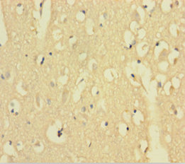 AFTPH Polyclonal Antibody (20 µl)