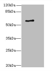ALAS2 Polyclonal Antibody