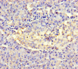 AMTN Polyclonal Antibody