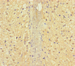 AP3M2 Polyclonal Antibody
