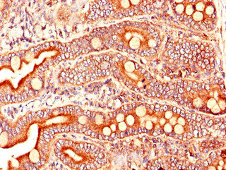 ARL6IP5 Polyclonal Antibody