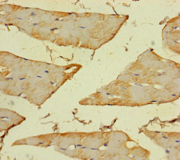 ASAH2 Polyclonal Antibody