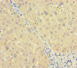 ASL Polyclonal Antibody