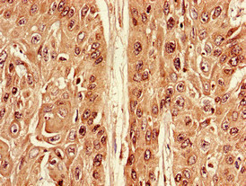 ATG7 Polyclonal Antibody