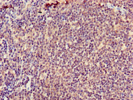 ATIC Polyclonal Antibody